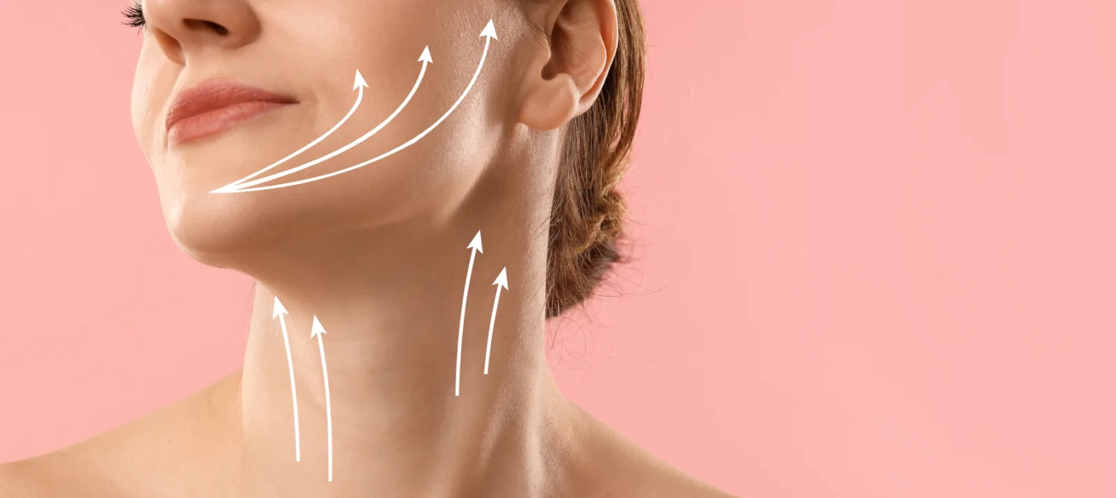 Jawline and neck contour treatment illustration