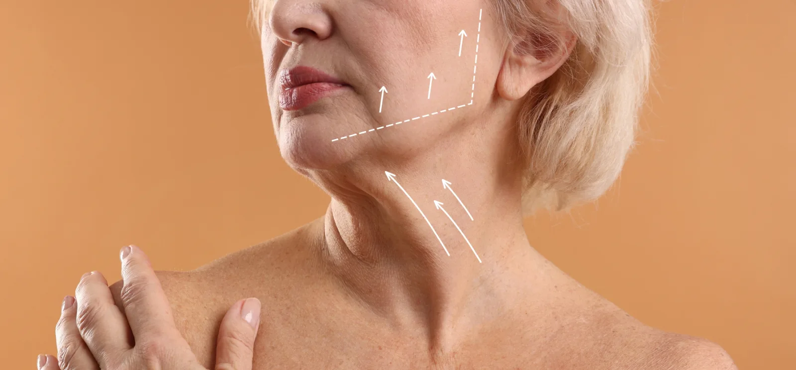 Jawline and neck structure assessment for a subtle, natural lift
